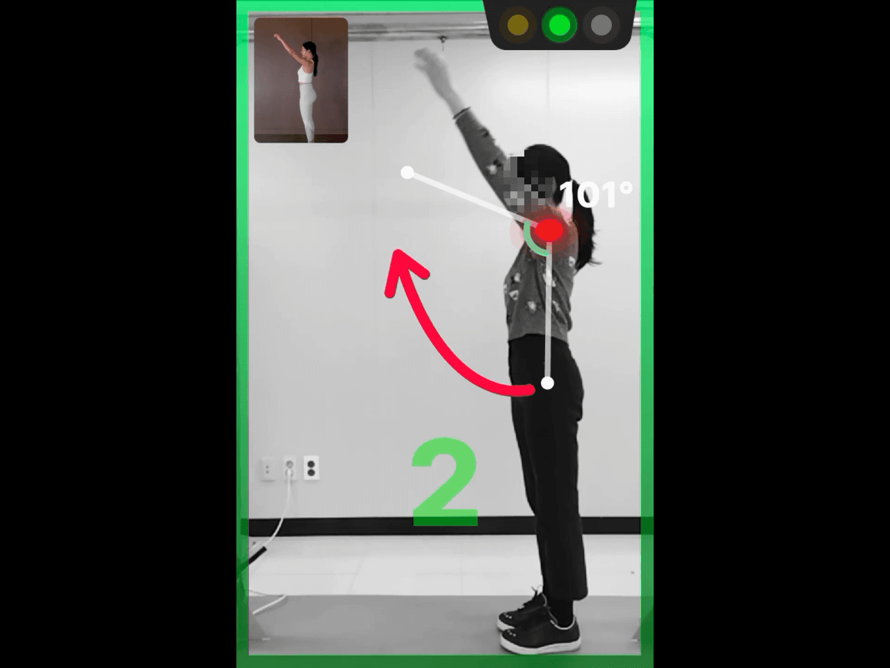 ANAPA PS — ROM measurement showing 101° shoulder range of motion